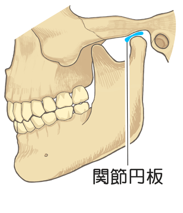 関節円板